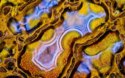 Local Places in Nikon Small World Photomicrography Competition